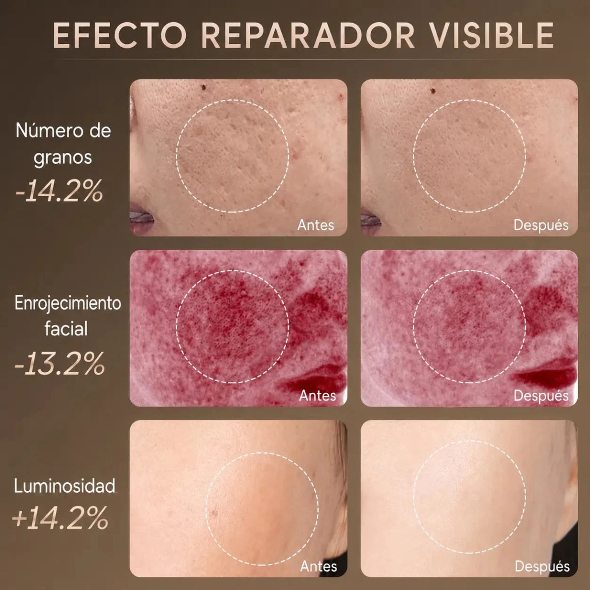 Luce una piel luminosa y juvenil con solo 10 minutos al día - Encantory